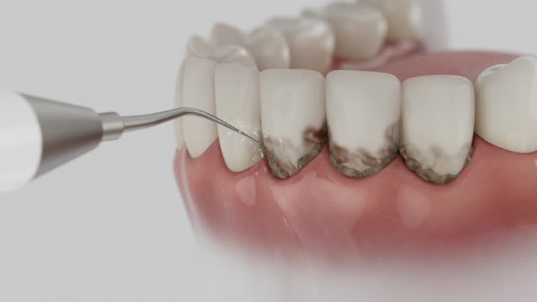 Reliable Dental contractor in State College, PA by Dentist Open Now